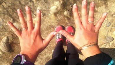 ورم دست‌ها حین دویدن