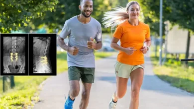 دویدن بعد از عمل دیسک کمر