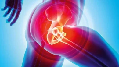 دویدن بعد از تعویض مفصل لگن