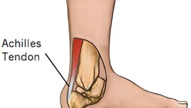 تصویر آناتومی از یک پا و نشان دادن آشیل تاندون در پشت پاشنه