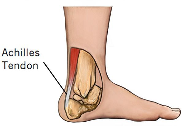 تصویر آناتومی از یک پا و نشان دادن آشیل تاندون در پشت پاشنه