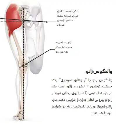 تصویری از دونده با والگوس زانو از کتاب علم دویدن مصور